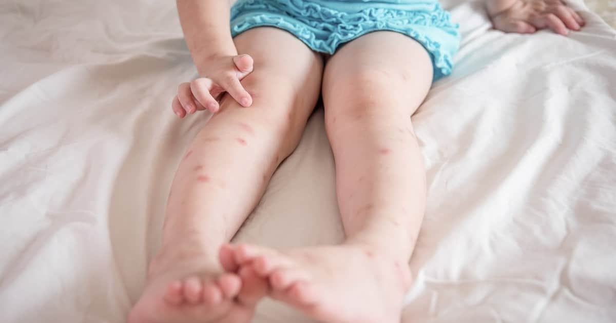 Advierten por un hábito que sube el riesgo de que los niños desarrollen las alergias que potenció la pandemia