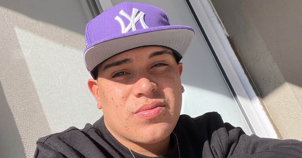 A un año del accidente que casi le cuesta la vida, Thiago Medina mostró las cicatrices que le quedaron: "Me da vergüenza"